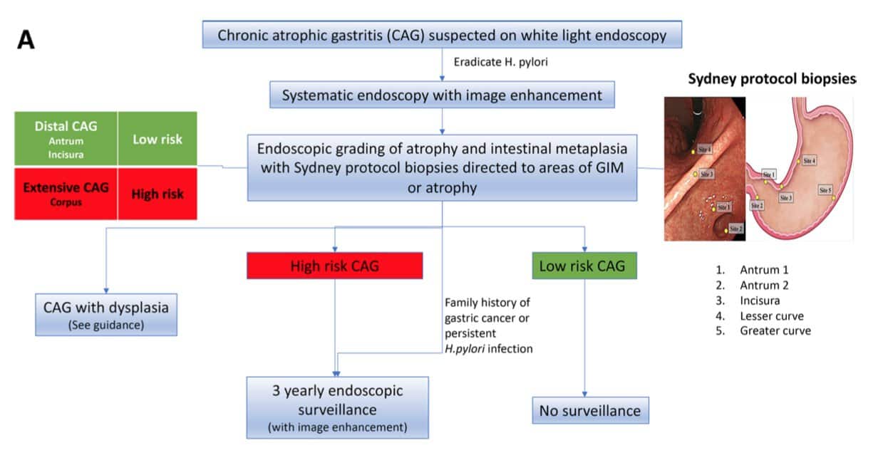 BSG - Gastric Atrophy Surveillance